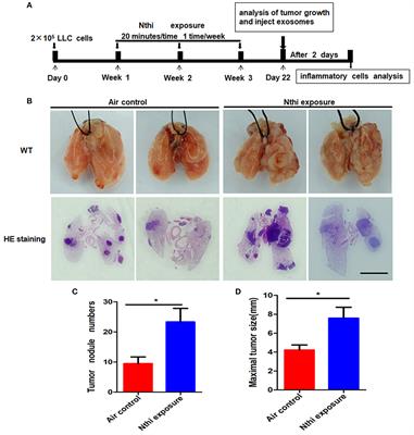 Bronchoalveolar Lavage Fluid-Derived Exosomes: A Novel Role Contributing to Lung Cancer Growth